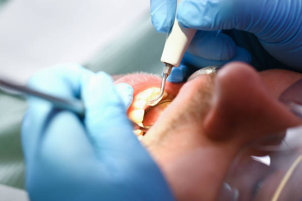 Best Broken or Chipped Tooth Repair in Belle Plaine, MN