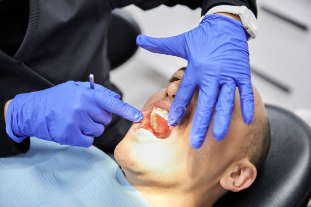 Best Knocked-Out Tooth (Avulsed Tooth) Treatment in Belle Plaine, MN